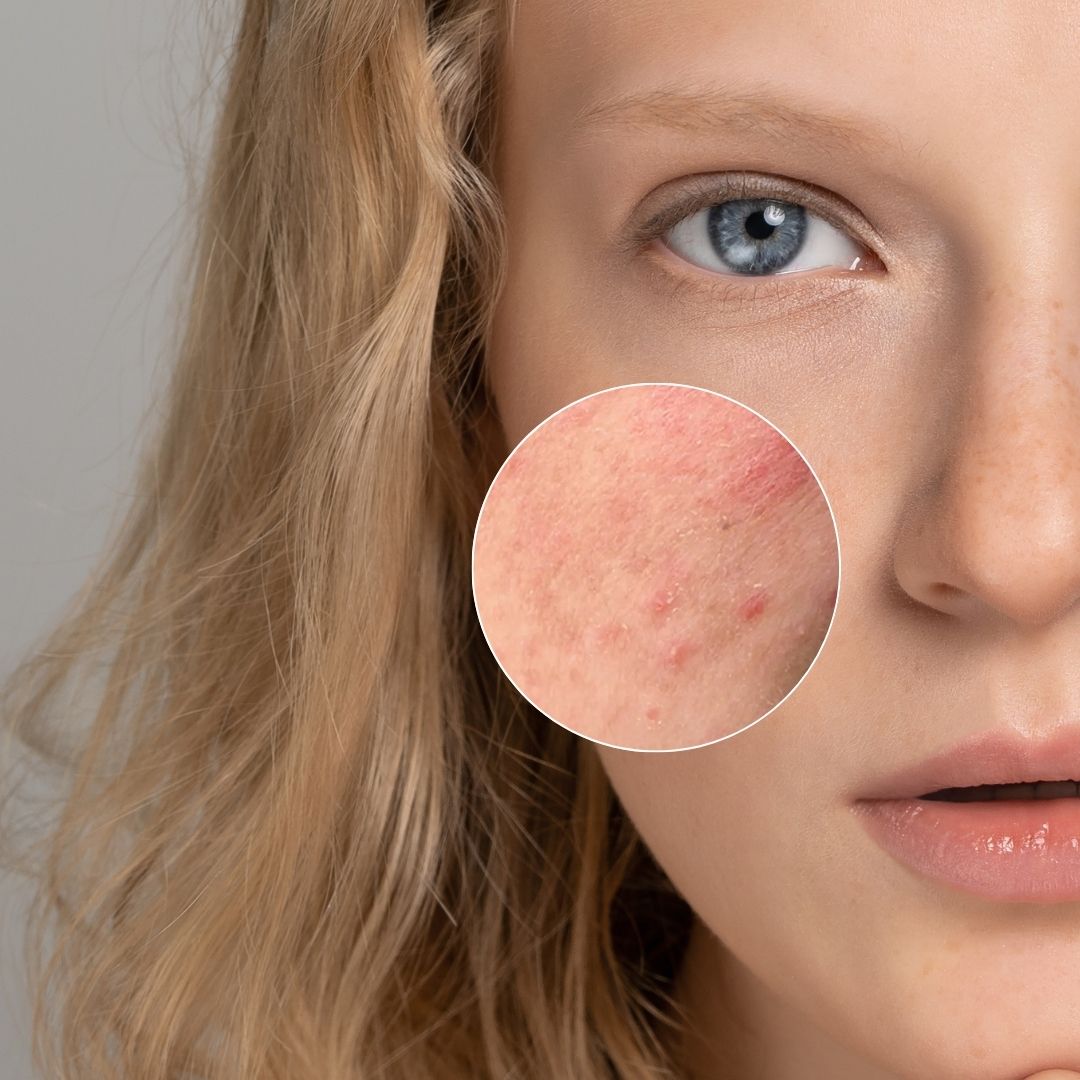 Neuro Skin Balm | 100ml