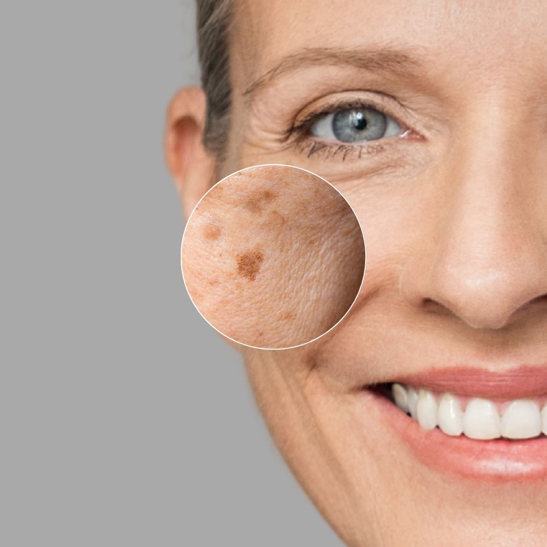 Dark Spot Perfector 30ml