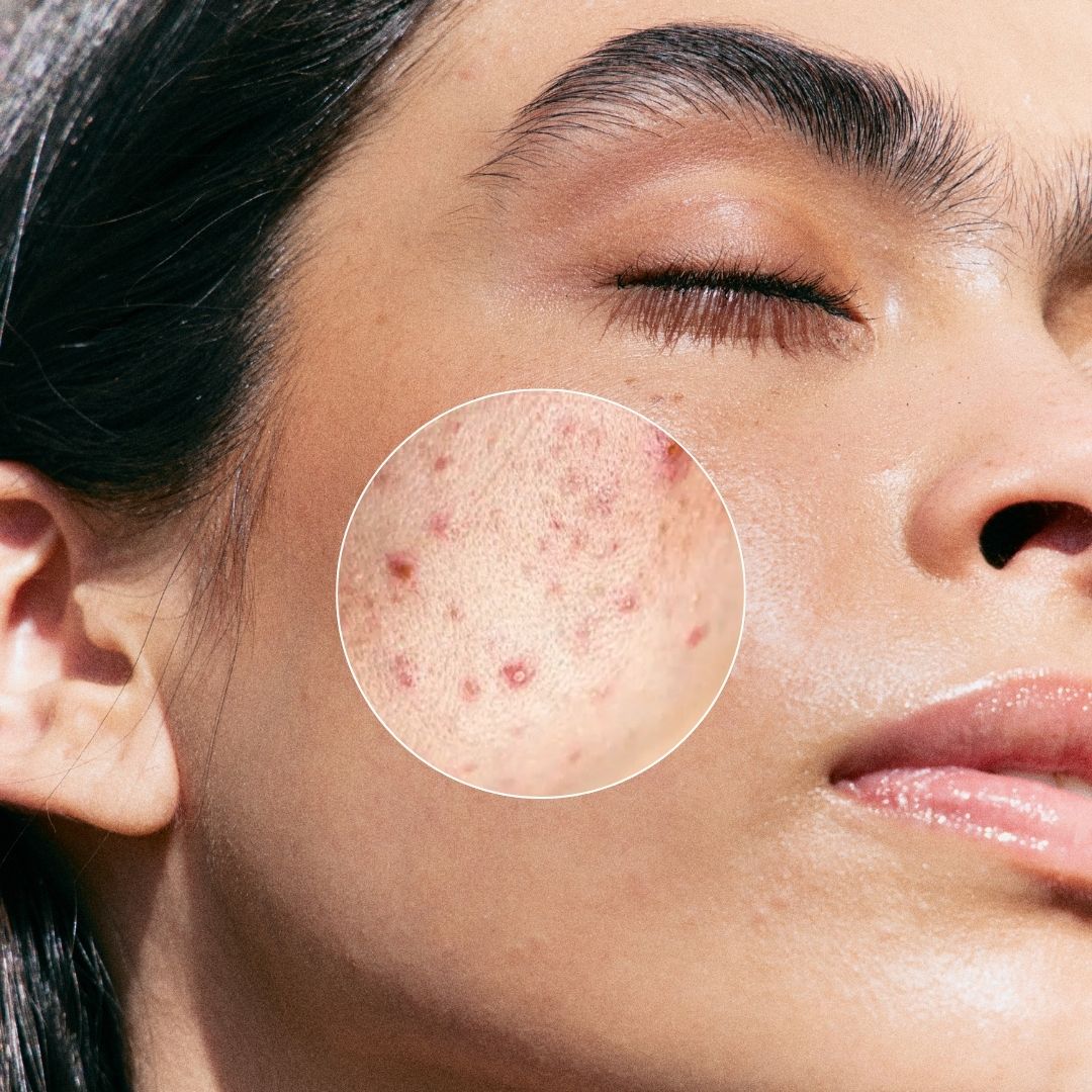 AHA + BHA Exfoliator 30ml