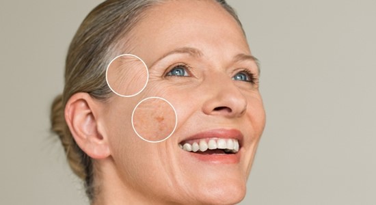 Sonnenschäden vorbeugen & lindern – mit professioneller Hautpflege